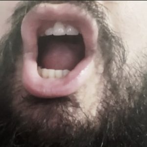 Clueless Bloated Bully (17:30)